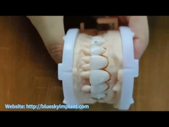 تاج زرکونیا با جواهرات