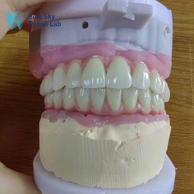 خرید سازگاری جهانی پل مالو فلزی با قاب تیتانیوم خالص online manufacture