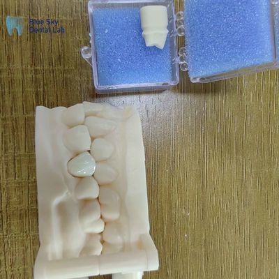 خرید جمالیات زیرکونیا بازسازی دندان های زیرکونیا تاج های پورسلین online manufacture