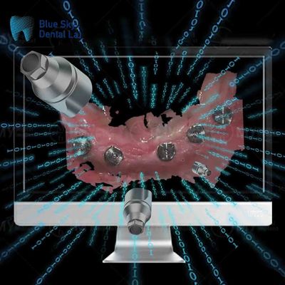 خرید بدن اسکن مستقیم ایمپلنت قابل استفاده مجدد همه در یک بدن اسکن دندان online manufacture
