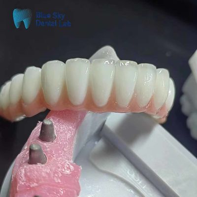 خرید کوله ایمپلنت زرکونیا معمولی کوله ایمپلنت دندان شخصی online manufacture