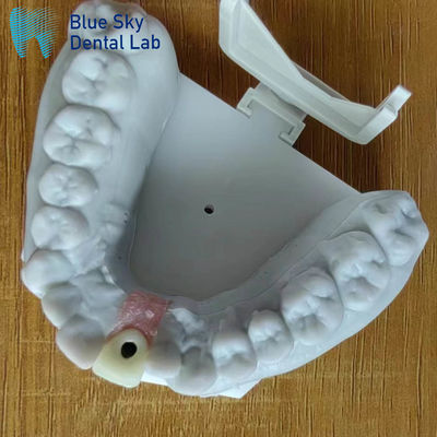 خرید استریلیزه کردن با بخار تاج ایمپلنت تک سطح صاف تاج ایمپلنت دندان online manufacture