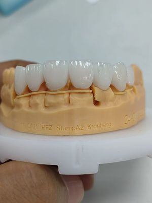 خرید 5mm-6mm تاج زرکونیا لایه دار قدرت تاج زرکونیا چند لایه online manufacture