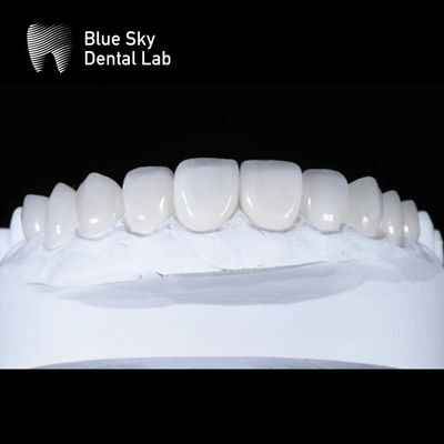 خرید قاب های فنیر پرمیوم شیک 0.3mm Ultra Thin Emax Veneers online manufacture