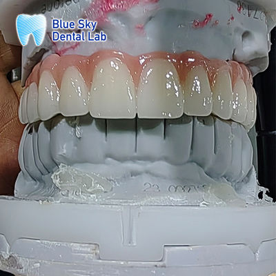 خرید کاور ایمپلنت مصنوعی دندان کاور ایمپلنت استریلیزه چندگانه online manufacture