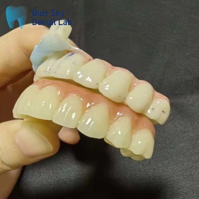 خرید موارد کاشت مصنوعی موارد کاشت مصنوعی برای سازگاری سیستم بدون درز online manufacture