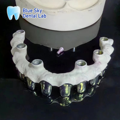 خرید دندانهاي قاب فلزي نقره اي خالص تيتانيوم online manufacture