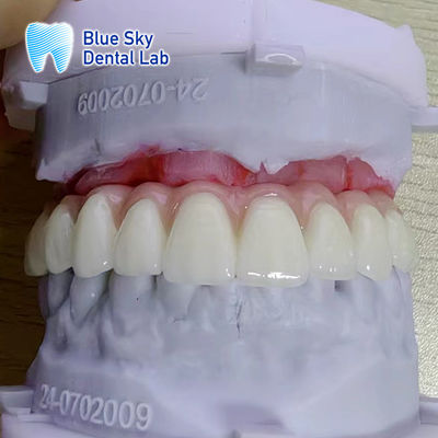 خرید سفارشی رنگ سطح صاف کاور ابزار کاشت online manufacture