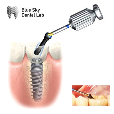 خرید درونی Hex ASC Abutment قابل تنظیم زاویه دار پیچ کانال Abutment online manufacture