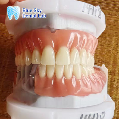 خرید پروتز پاره ای قابل برداشتن از رزین آکریلیک با کلپس و پروتز کامل آکریلیک online manufacture