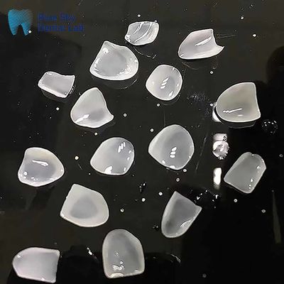فرنیر های فوق نازک E Max Ingot Class فرنیر های سرامیکی طبیعی