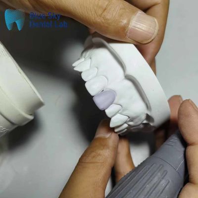 0.3mm شیشه نازک سرامیک فنیر ایمپلنت های فنیر سبک
