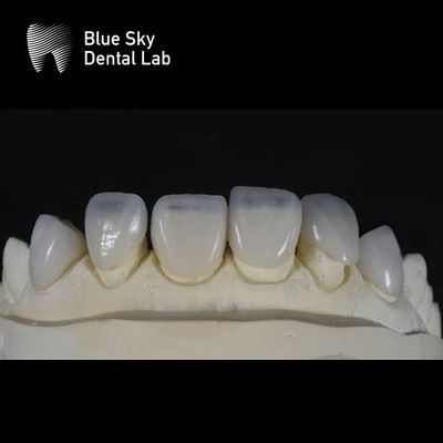 Ultra Thin Sleek Veneer Cases 0.3mm نازک ترین ورودی های سفارشی