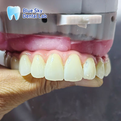 موارد کاشت برای سیستم های کاشت چندگانه