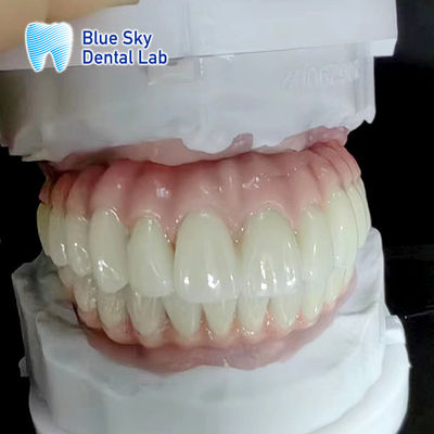 نوع و دوام دستگاه های پزشکی