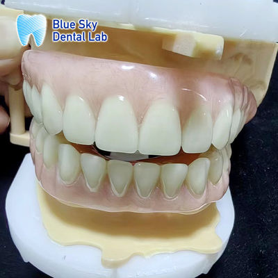 دندان مصنوعی پاره ای آکریلیک موقت آبی و کامل دندان مصنوعی آکریلیک بالا و پایین