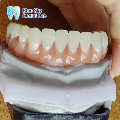 دندانهاي کامل آکریلیک راحت دندانهاي رزین آکریلی با ظاهر طبیعی
